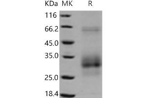 Western Blotting (WB) image for TNF Receptor Superfamily, Member 6 (FAS) (Active) protein (His tag) (ABIN7321232) (FAS Protein (His tag))