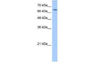 WB Suggested Anti-SLC22A11 Antibody Titration:  1.