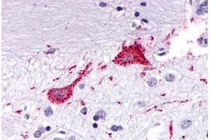 Immunohistochemical (Formalin/PFA-fixed paraffin-embedded sections) staining in human brain, neurons and glia with KISS1R polyclonal antibody . (KISS1R Antikörper  (3rd Cytoplasmic Domain))