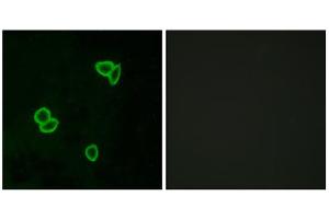 Immunofluorescence analysis of LOVO cells, using LPHN1 antibody. (Latrophilin 1 Antikörper  (Internal Region))