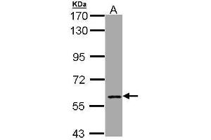 Western Blotting (WB) image for anti-Core-binding Factor, Runt Domain, alpha Subunit 2, Translocated To, 2 (CBFA2T2) (C-Term) antibody (ABIN2856638)
