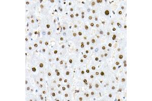 Immunohistochemistry of paraffin-embedded human liver using Nucleolin Rabbit mAb (ABIN7269035) at dilution of 1:25 (40x lens). (Nucleolin Antikörper)