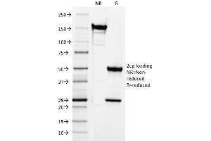 SDS-PAGE (SDS) image for anti-CD3 epsilon (CD3E) antibody (ABIN6941029)