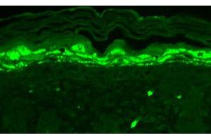 Immunohistochemistry analysis using Mouse Anti-SHANK1 Monoclonal Antibody, Clone S22-21 . (SHANK1 Antikörper  (AA 469-691) (Atto 594))