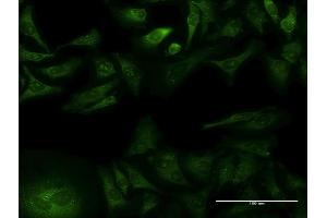 Immunofluorescence of monoclonal antibody to GFRA1 on HeLa cell.