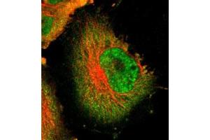 Immunofluorescent staining of U-251 MG with USP5 polyclonal antibody  (Green) shows positivity in cytoplasm and nucleus but excluded from the nucleoli. (USP5 Antikörper)