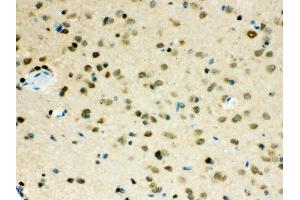 Immunohistochemistry (IHC) image for anti-Valosin Containing Protein (VCP) (AA 732-760), (C-Term) antibody (ABIN3043958)