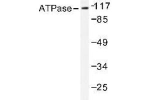 Western blot (WB) analysis of Na+/K+ ATPase alpha-1 antibody in extracts from 293 PMA 125ng/ml 30' cells. (ATP1A1 Antikörper)