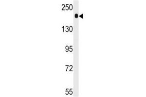 Western blot analysis of ACE antibody and mouse lung tissue lysate.