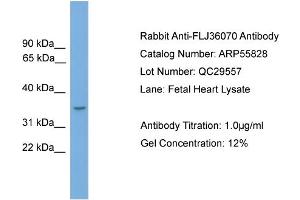 WB Suggested Anti-FLJ36070  Antibody Titration: 0. (FLJ36070 (N-Term) Antikörper)
