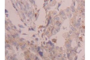 Used in DAB staining on fromalin fixed paraffin-embedded Kidney tissue
