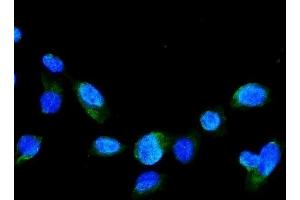 IF analysis of GRK2 using anti-GRK2 antibody (ABIN5693069). (GRK2 Antikörper)