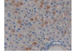 IHC-P analysis of Mouse Liver Tissue, with DAB staining. (COMP Antikörper  (AA 554-753))
