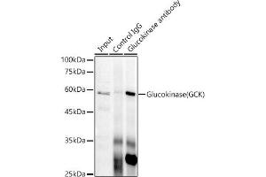 Immunoprecipitation analysis of 300 μg extracts of HeLa cells using 3 μg Glucokinase (GCK) antibody (ABIN7267396). (GCK Antikörper)