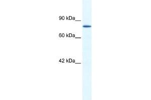 WB Suggested Anti-ZNF214 Antibody Titration:  1. (ZNF214 Antikörper  (N-Term))
