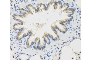 Immunohistochemistry of paraffin-embedded Rat lung using TICAM1 Polyclonal Antibody at dilution of 1:100 (40x lens). (TICAM1 Antikörper)