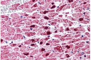 Human Heart (formalin-fixed, paraffin-embedded) stained with PPARG antibody ABIN214562 at 5 ug/ml followed by biotinylated goat anti-rabbit IgG secondary antibody ABIN481713, alkaline phosphatase-streptavidin and chromogen. (PPARG Antikörper  (Internal Region))