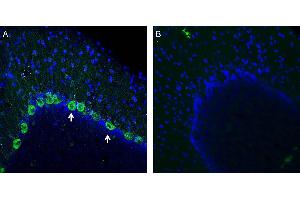 Expression of NMUR1 in rat cerebellum. (NMUR1 Antikörper  (Extracellular))