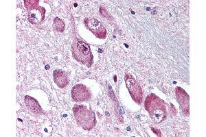 Anti-GABRA3 antibody IHC of human brain, basal nucleus of Meynert. (GABRA3 Antikörper  (N-Term))