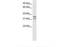 Image no. 1 for anti-NK2 Homeobox 2 (Nkx2-2) (AA 30-79) antibody (ABIN6736071) (Nkx2-2 Antikörper  (AA 30-79))