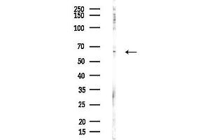 Western blot analysis of lysates from Hela cells(heat-shock,45 min treatment), using AMPK alpha 1 Antibody at 1/1000 dilution.