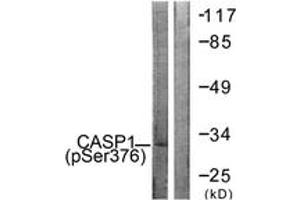 Western blot analysis of extracts from 293 cells, using Caspase 1 (Phospho-Ser376) Antibody. (Caspase 1 Antikörper  (pSer376))