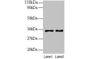Western blot All lanes: PTDSS1 antibody at 2 μg/mL Lane 1: EC109 whole cell lysate Lane 2: 293T whole cell lysate Secondary Goat polyclonal to rabbit IgG at 1/15000 dilution Predicted band size: 56, 39, 35 kDa Observed band size: 35 kDa
