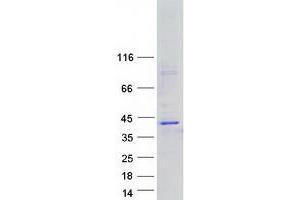 Validation with Western Blot