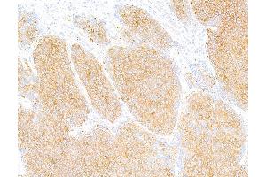 Immunohistochemistry (IHC) image for anti-Tubulin, beta (TUBB) (AA 1-50) antibody (ABIN7453995) (Rekombinanter TUBB Antikörper  (AA 1-50))