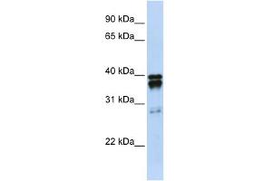 Western Blotting (WB) image for anti-Nudix (Nucleoside Diphosphate Linked Moiety X)-Type Motif 18 (NUDT18) (N-Term) antibody (ABIN2783562)