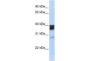 WB Suggested Anti-NUDT18 Antibody Titration:  0. (NUDT18 Antikörper  (N-Term))