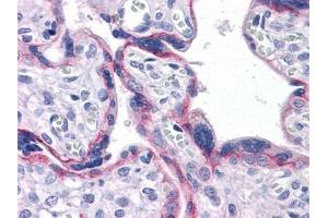 Immunohistochemical analysis of paraffin-embedded human Placenta tissues using CDH2 antibody (N-Cadherin Antikörper)