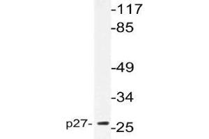 Western blot (WB) analysis of p27 antibody in extracts from NIH/3T3cells. (CDKN1B Antikörper)