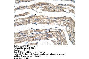 Human Muscle (ZNF197 Antikörper  (N-Term))
