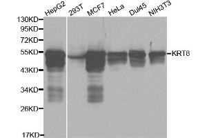 Western blot analysis of extracts of various cell lines, using KRT8 antibody (ABIN5970401) at 1/1000 dilution. (KRT8 Antikörper)