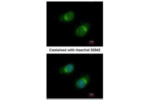 ICC/IF Image Immunofluorescence analysis of methanol-fixed HeLa, using COL3A1, antibody at 1:50 dilution. (COL3A1 Antikörper  (C-Term))