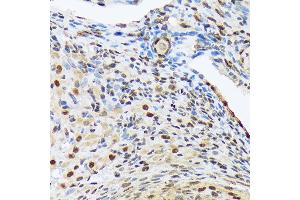 Immunohistochemistry of paraffin-embedded rat ovary using HES5 Rabbit mAb (ABIN7267559) at dilution of 1:100 (40x lens). (HES5 Antikörper)