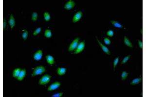 Immunofluorescent analysis of A549 cells using ABIN7145784 at dilution of 1:100 and Alexa Fluor 488-congugated AffiniPure Goat Anti-Rabbit IgG(H+L) (BIN3 Antikörper  (AA 8-240))