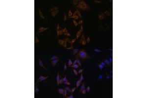 Immunofluorescence analysis of HeLa cells using UBE2L6 antibody (ABIN6134446, ABIN6149808, ABIN6149809 and ABIN6217753) at dilution of 1:100. (UBE2L6 Antikörper  (C-Term))