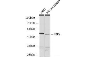 Western blot analysis of extracts of various cell lines using SKP2 Polyclonal Antibody at dilution of 1:1000. (SKP2 Antikörper)