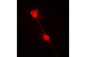 Immunofluorescent analysis of IKB alpha staining in HepG2 cells. (NFKBIA Antikörper  (N-Term))