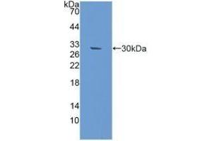 Detection of Recombinant RAD50, Mouse using Polyclonal Antibody to DNA Repair Protein RAD50 (RAD50) (RAD50 Antikörper  (AA 1-234))