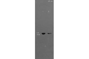 L1 Mouse liver lysates, L2 Mouse cerebrum lysates probed with Anti- EDG2/LPA1 Polyclonal Antibody, Unconjugated (ABIN681103) at 1:300 in 4 °C. (LPAR1 Antikörper  (AA 281-364))