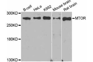 Western blot analysis of extracts of various cell lines, using MTOR antibody (ABIN5998278) at 1/1000 dilution. (MTOR Antikörper)