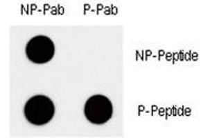 Dot blot analysis of phospho c-Myc antibody. (c-MYC Antikörper  (pThr58))