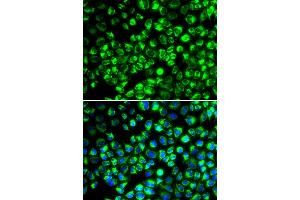 Immunofluorescence analysis of HeLa cells using ATP6AP2 antibody (ABIN5973915). (ATP6AP2 Antikörper)