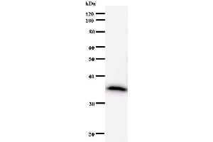 Western Blotting (WB) image for anti-DEAD (Asp-Glu-Ala-Asp) Box Polypeptide 5 (DDX5) antibody (ABIN933122) (DDX5 Antikörper)
