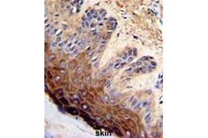 Formalin-fixed and paraffin-embedded human skin with TOP2A Antibody (C-term), which was peroxidase-conjugated to the secondary antibody, followed by DAB staining. (Topoisomerase II alpha Antikörper  (C-Term))