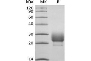Western Blotting (WB) image for CD79b Molecule, Immunoglobulin-Associated beta (CD79B) protein (His tag) (ABIN7321037)
