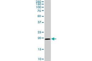 SRI monoclonal antibody (M01), clone 1E12. (SRI Antikörper  (AA 1-198))